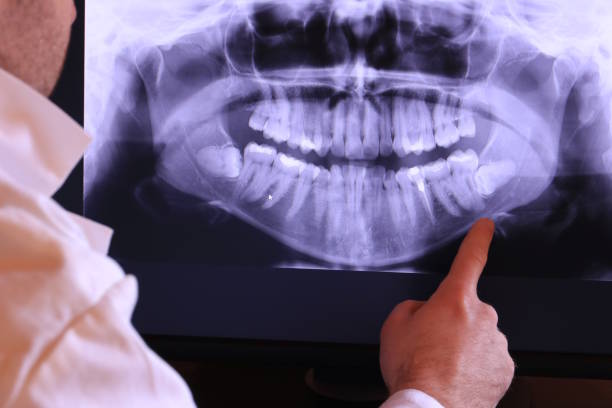 Best Emergency Root Canal Treatment in St Johns, AZ